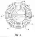 Fig. 06 - Fluid filter