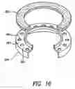 Fig. 16 - Fluid filter