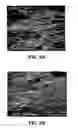 Fig. 03 - Implant surface preparation