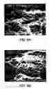 Fig. 04 - Implant surface preparation