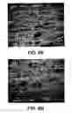 Fig. 06 - Implant surface preparation