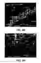 Fig. 07 - Implant surface preparation