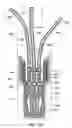 Fig. 61 - Insulated conductor temperature limited heater for subsurface heating coupled in a three-phase WYE configuration