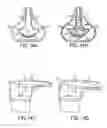 Fig. 13 - Dispensing device for multiple constituent systems