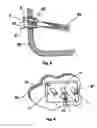 Fig. 04 - Burner and gas-injection device