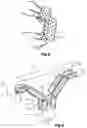 Fig. 05 - Bracket stripping