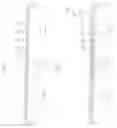 Fig. 05 - Semiconductor chip having bond pads