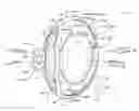 Fig. 01 - Single-piece accommodating intraocular lens system