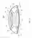 Fig. 24 - Single-piece accommodating intraocular lens system