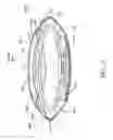 Fig. 28 - Single-piece accommodating intraocular lens system