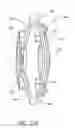 Fig. 29 - Single-piece accommodating intraocular lens system