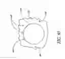 Fig. 48 - Single-piece accommodating intraocular lens system