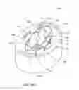 Fig. 53 - Single-piece accommodating intraocular lens system