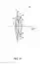 Fig. 60 - Single-piece accommodating intraocular lens system
