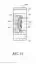 Fig. 66 - Single-piece accommodating intraocular lens system