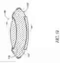 Fig. 67 - Single-piece accommodating intraocular lens system