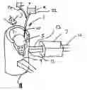 Fig. 01 - Molten metal processing