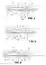 Fig. 04 - Accumulation system for processing media items of various sizes and types