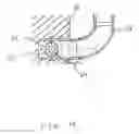 Fig. 11 - UNIVERSAL HELPER STEP FOR CLASS 8 TRACTORS, TRAILERS AND OTHER TRUCK APPLICATIONS