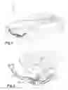 Fig. 02 - Torque crossmember