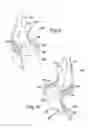 Fig. 08 - Protective chair