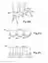 Fig. 17 - Protective chair