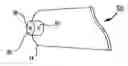Fig. 01 - Method and apparatus for improving the quality of kinematic MR images