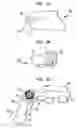 Fig. 03 - Method and apparatus for improving the quality of kinematic MR images