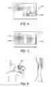 Fig. 03 - Imaging apparatus that can display both real-time images and recorded images simultaneously