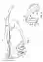Fig. 02 - Eyewear with clip-on frame and lens