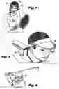 Fig. 03 - Focus-enhancing blinders