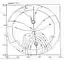 Fig. 01 - Error-tolerant progressive glass design