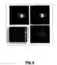Fig. 09 - System and method for robust optic disk detection in retinal images using vessel structure and radon transform
