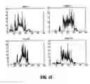 Fig. 11 - System and method for robust optic disk detection in retinal images using vessel structure and radon transform