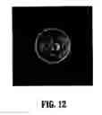 Fig. 13 - System and method for robust optic disk detection in retinal images using vessel structure and radon transform
