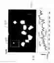 Fig. 09 - Spectral imaging of biofilms