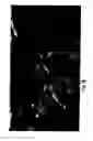 Fig. 10 - Spectral imaging of biofilms