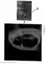 Fig. 07 - Method of forming a diffractive device
