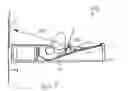 Fig. 06 - Apparatus for reducing socket shadow