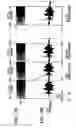 Fig. 17 - Method for measuring frequency characteristic and rising edge of impulse response, and sound field correcting apparatus