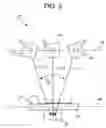 Fig. 03 - System and method for cross table tomosynthesis imaging for trauma applications