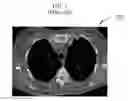 Fig. 02 - System and method for enhanced viewing of rib metastasis