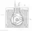 Fig. 01 - Infiltration pump having insulated rollers and programmable foot pedal
