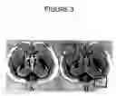 Fig. 04 - Methods for preparation of live body tissues for examination