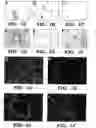 Fig. 02 - Methods for increasing capillary density and maintaining viability of microvascular cardiac endothelial cells using trk receptor ligands