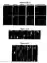 Fig. 43 - Centrosome proteins and uses thereof