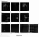 Fig. 07 - Methods and compositions targeting viral and cellular ITAM motifs, and use of same in identifying compounds with therapeutic activity