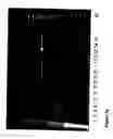 Fig. 07 - Protein purification means