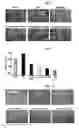 Fig. 02 - Composition comprising the alcohol compound isolated from the extract of cucurbitaceae family plant having anti-adipogenic and anti-obesity activity