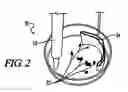 Fig. 03 - Indicator fixed ion-exchange membrane